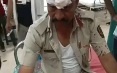 बिबट्याचा वनसंरक्षकावर हल्ला, उपचारासाठी घाटीत, शेतकऱ्यांमध्ये भीतीचे वातावरण